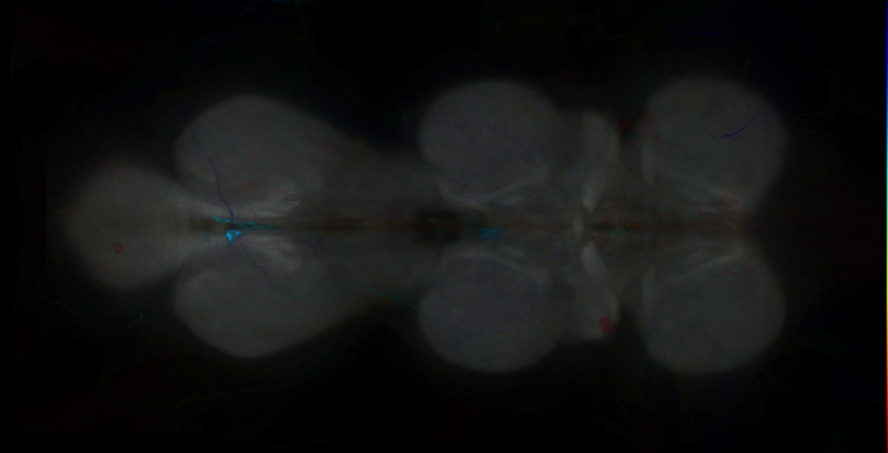 P{GMR65F09-GAL4} expression pattern