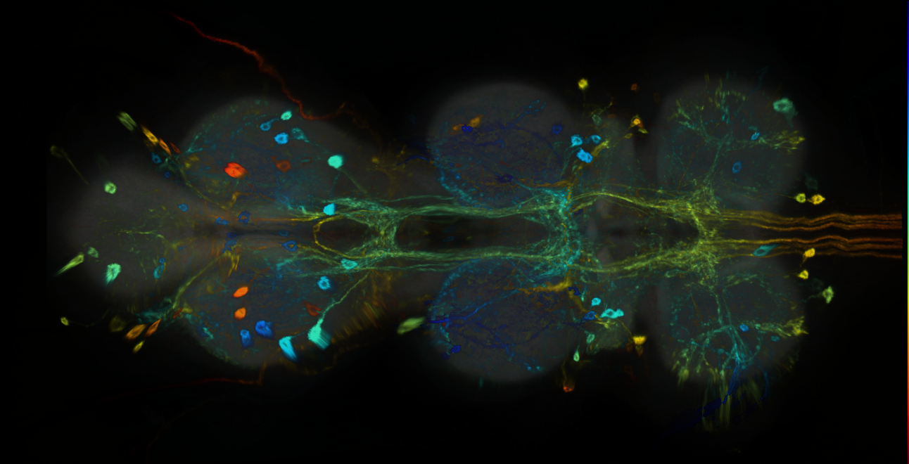 P{GMR65G04-GAL4} expression pattern