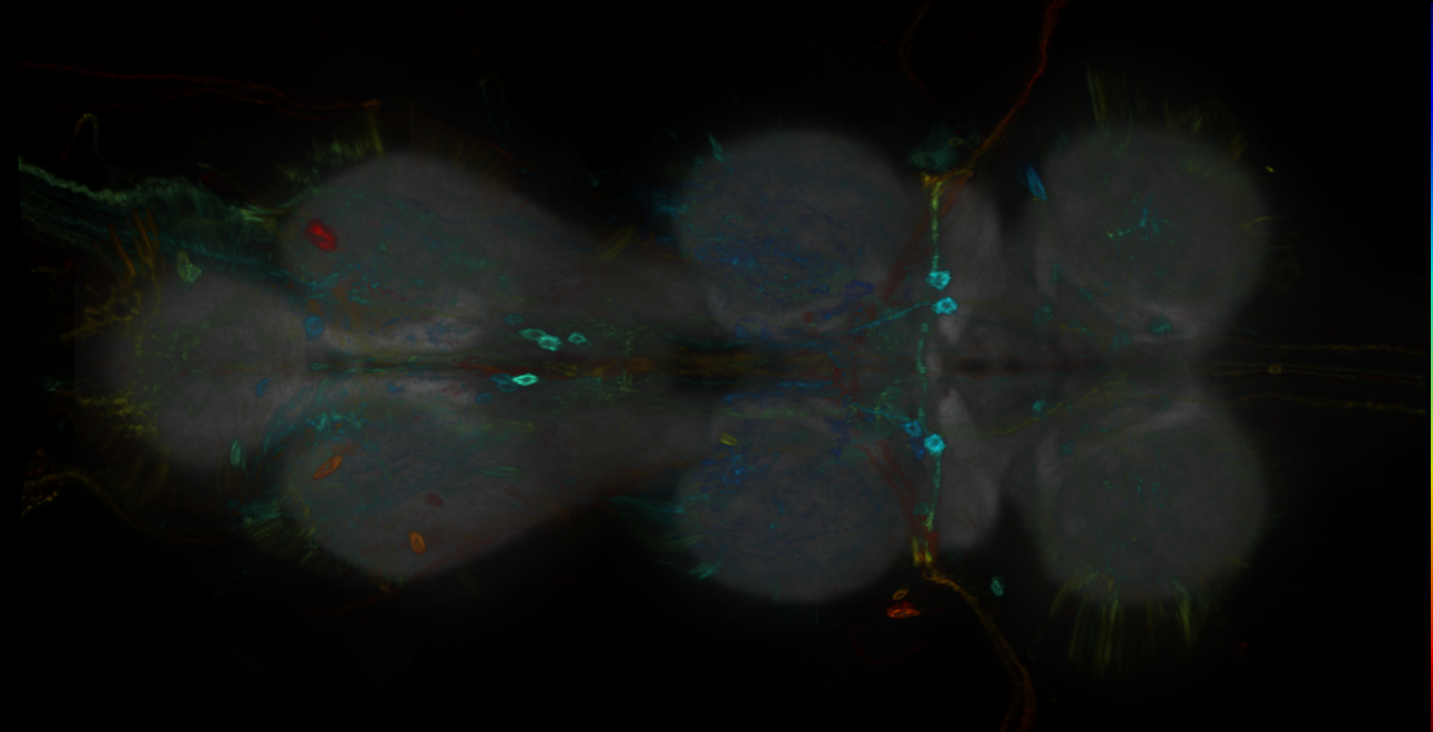P{GMR67A02-GAL4} expression pattern