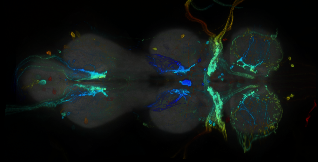 P{GMR67A03-GAL4} expression pattern
