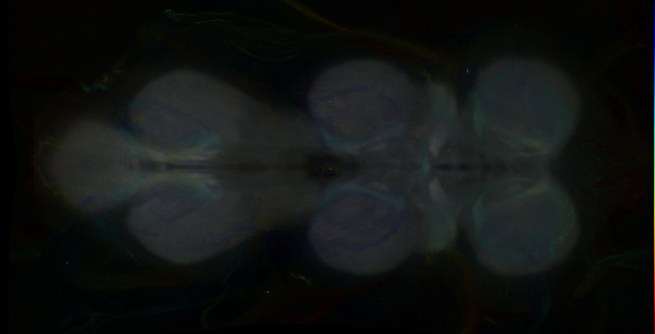 P{GMR69B08-GAL4} expression pattern