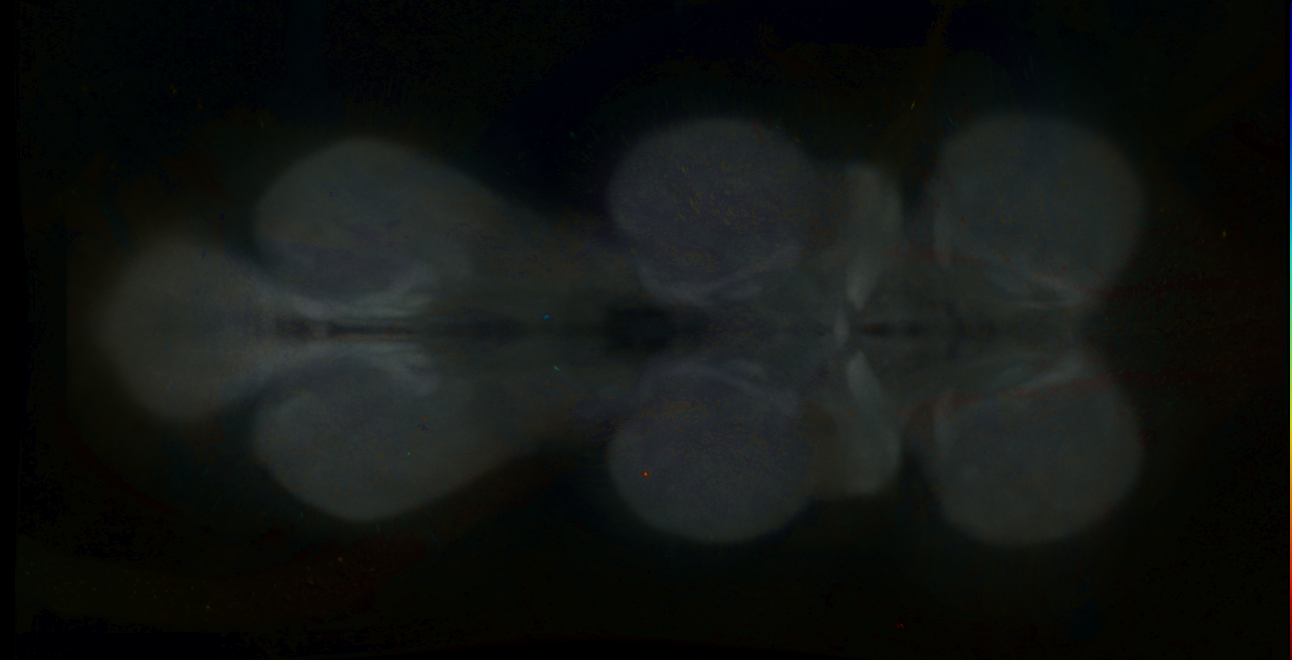 P{GMR69D04-GAL4} expression pattern