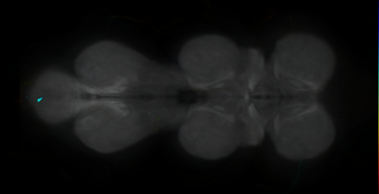 P{GMR69D10-GAL4} expression pattern