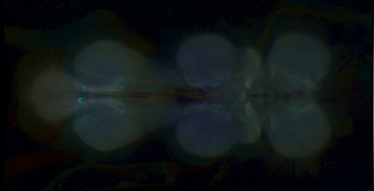 P{GMR69E07-GAL4} expression pattern