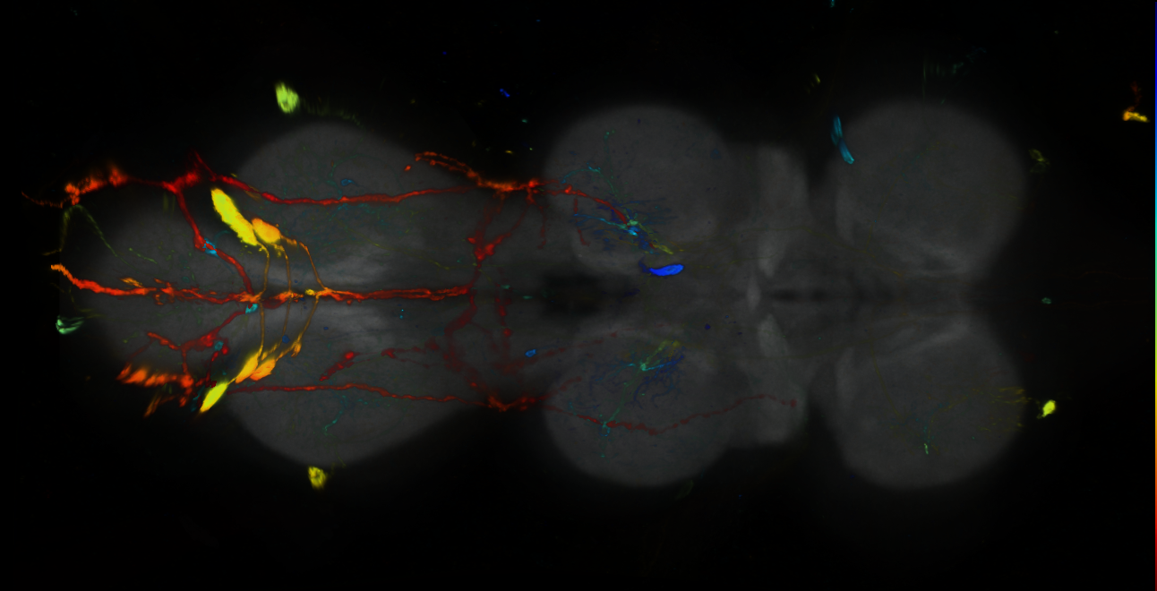 P{GMR70A05-GAL4} expression pattern