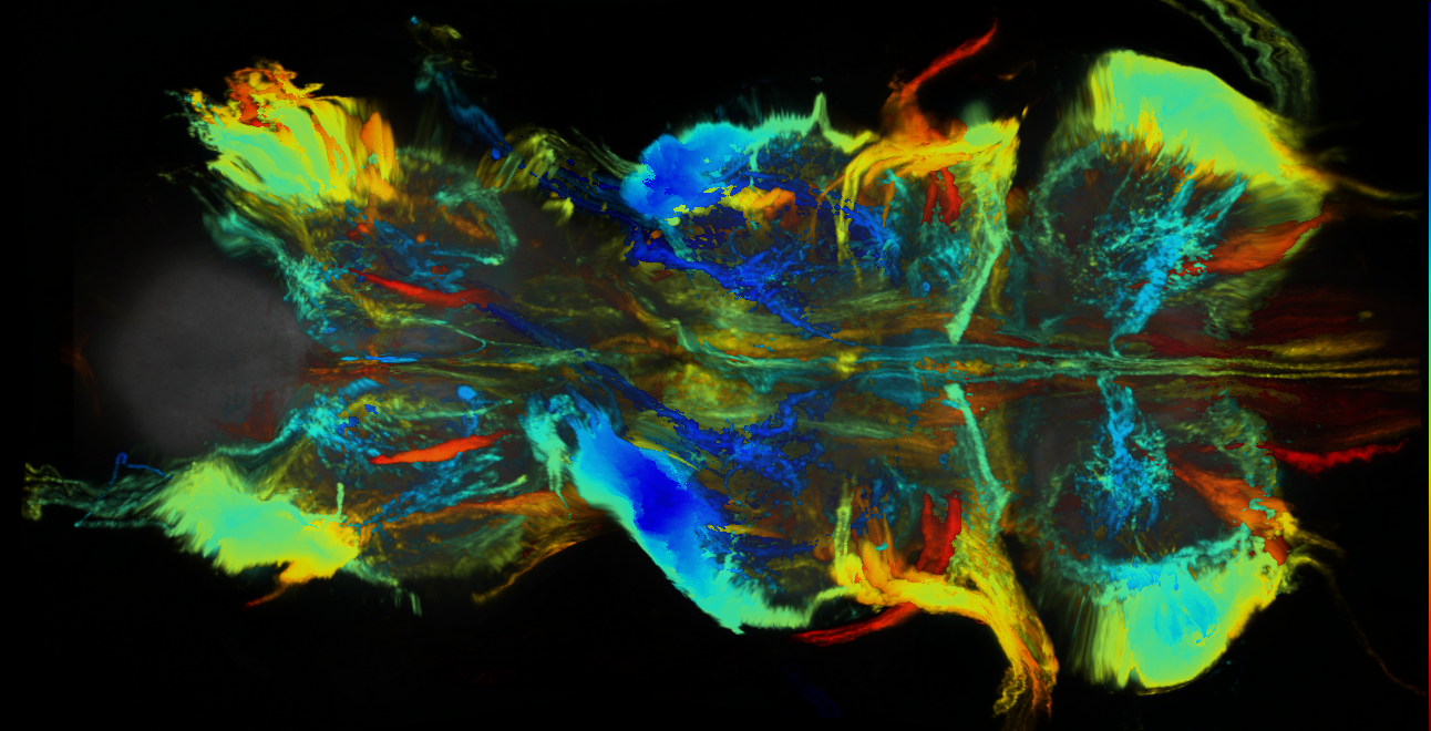 P{GMR70A06-GAL4} expression pattern