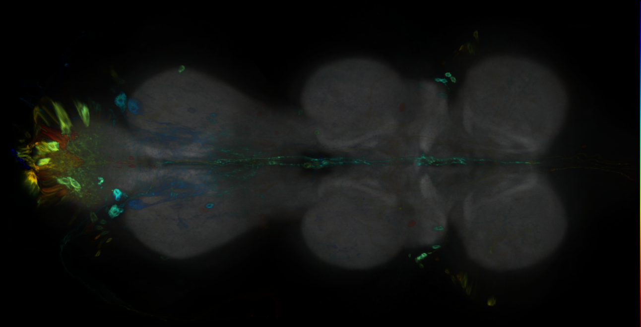 P{GMR70A08-GAL4} expression pattern