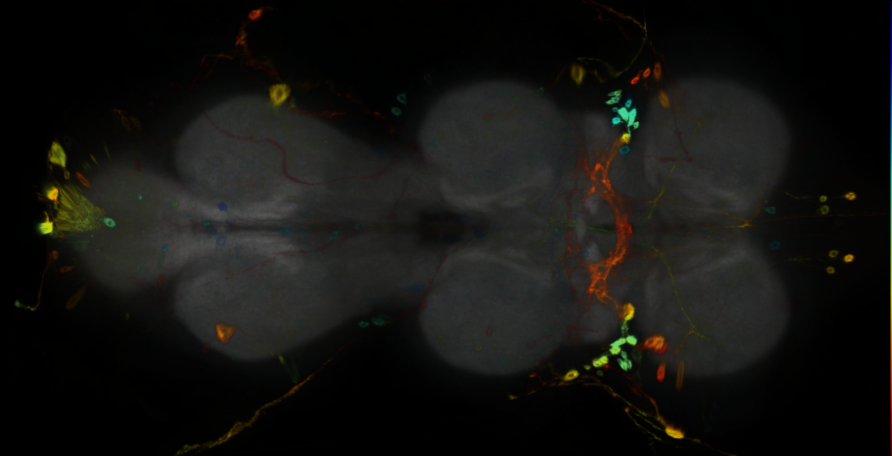 P{GMR70D01-GAL4} expression pattern
