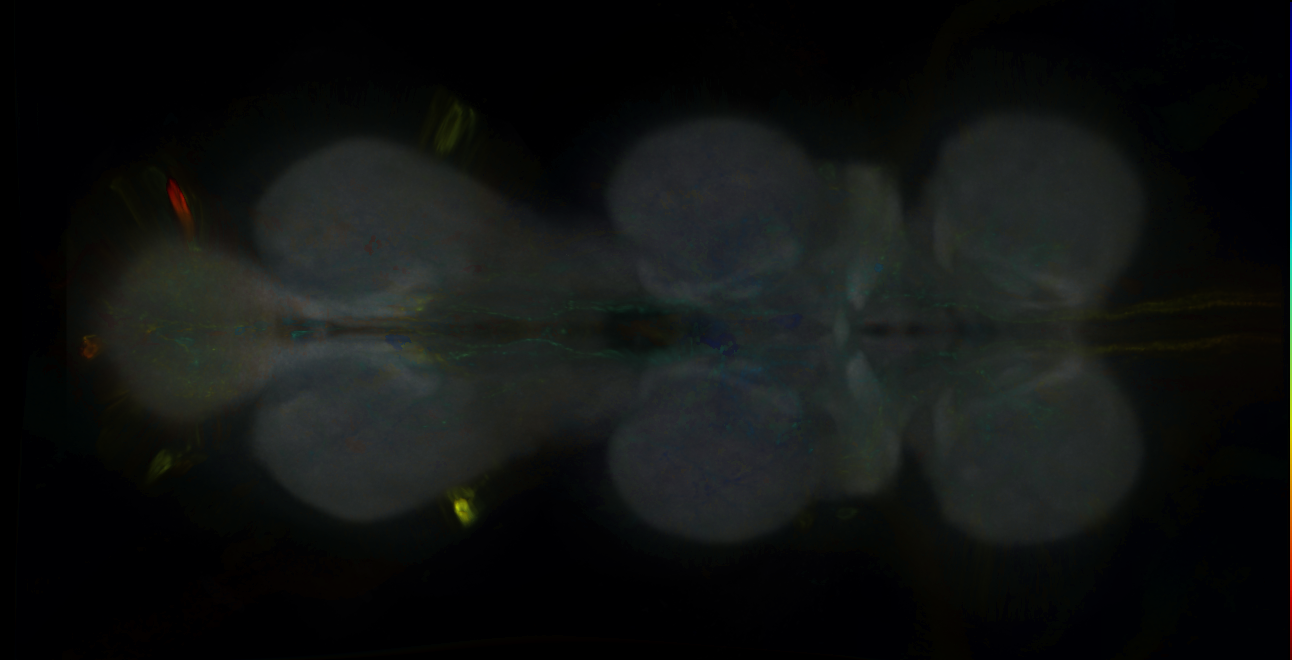 P{GMR70E05-GAL4} expression pattern