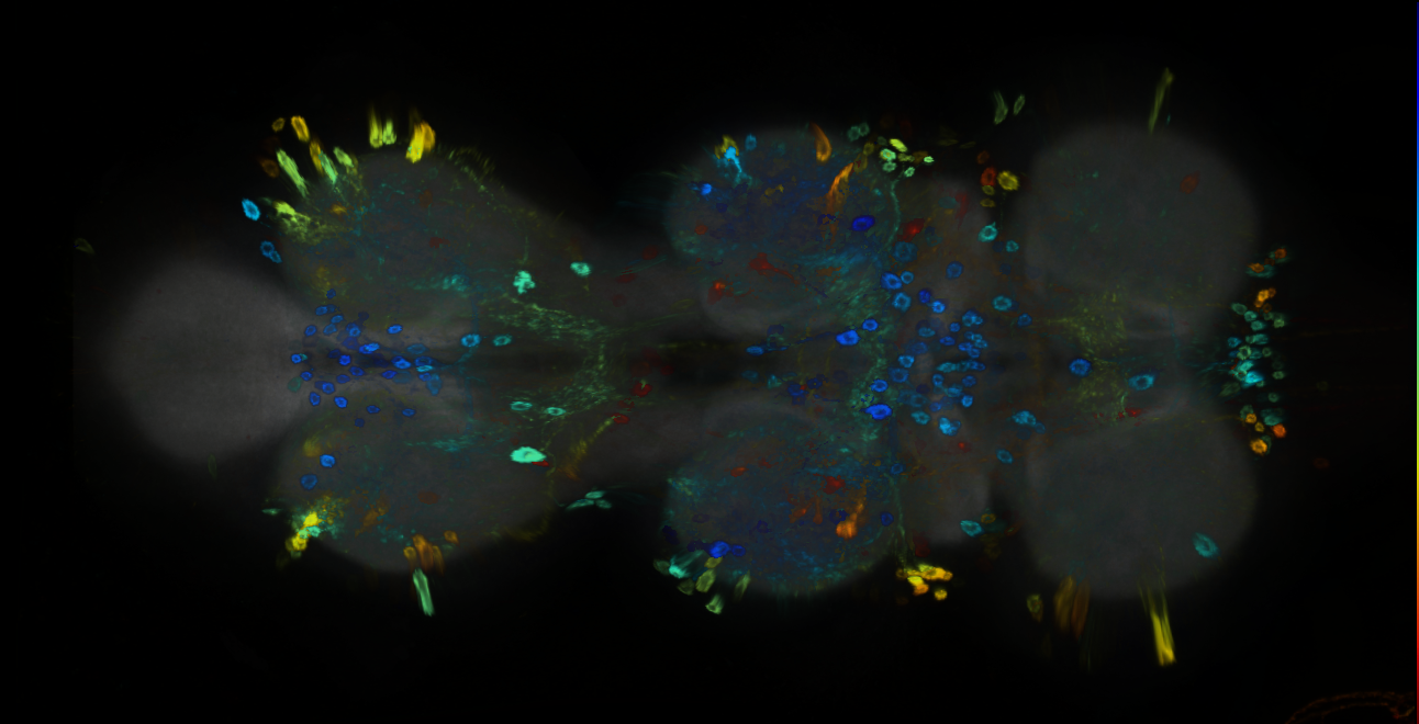 P{GMR70G05-GAL4} expression pattern
