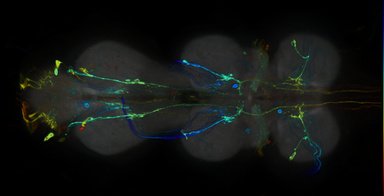 P{GMR70H02-GAL4} expression pattern