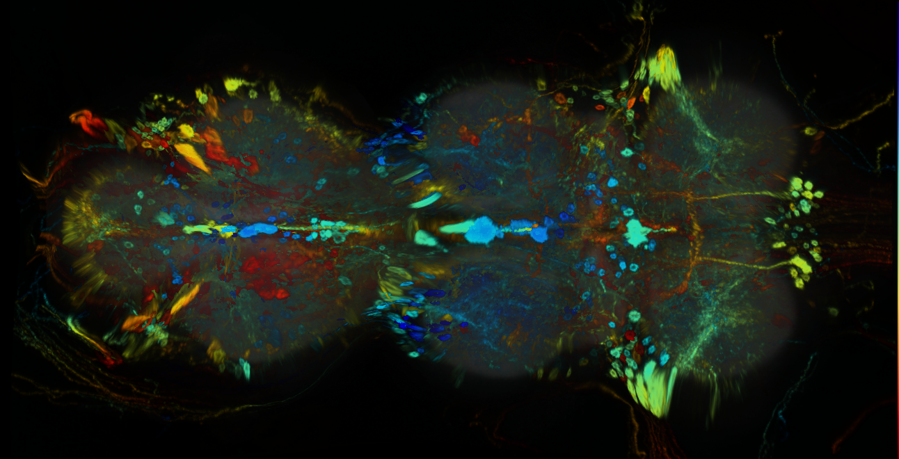 P{GMR70H10-GAL4} expression pattern