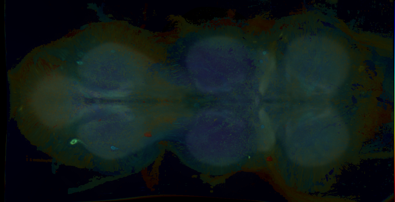 P{GMR71A03-GAL4} expression pattern