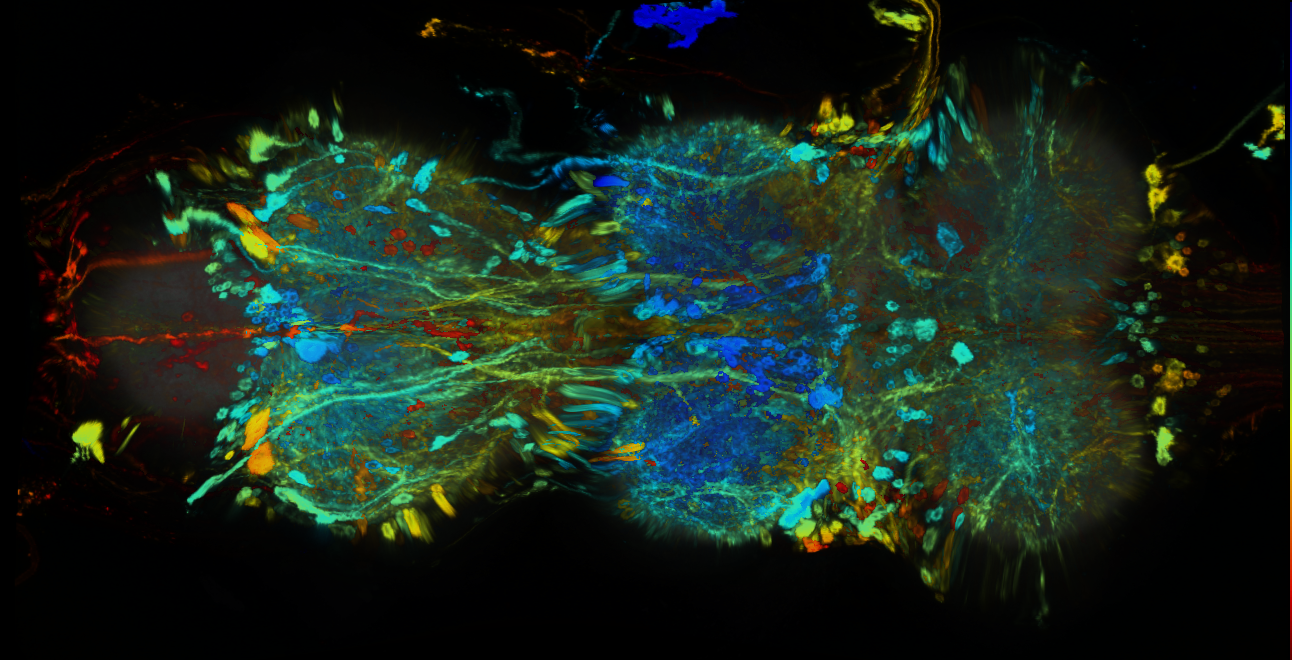 P{GMR71G05-GAL4} expression pattern
