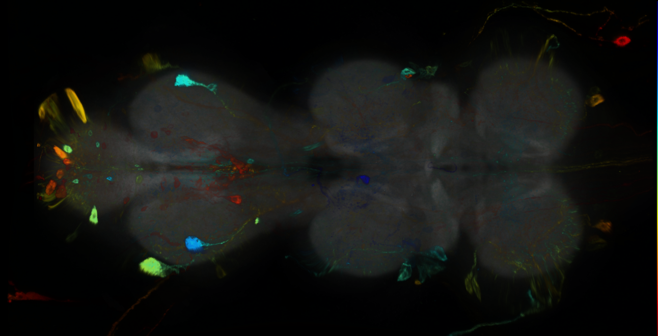 P{GMR72C11-GAL4} expression pattern