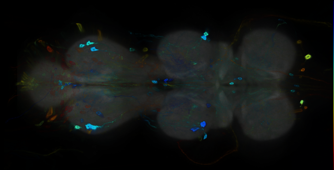 P{GMR72F01-GAL4} expression pattern