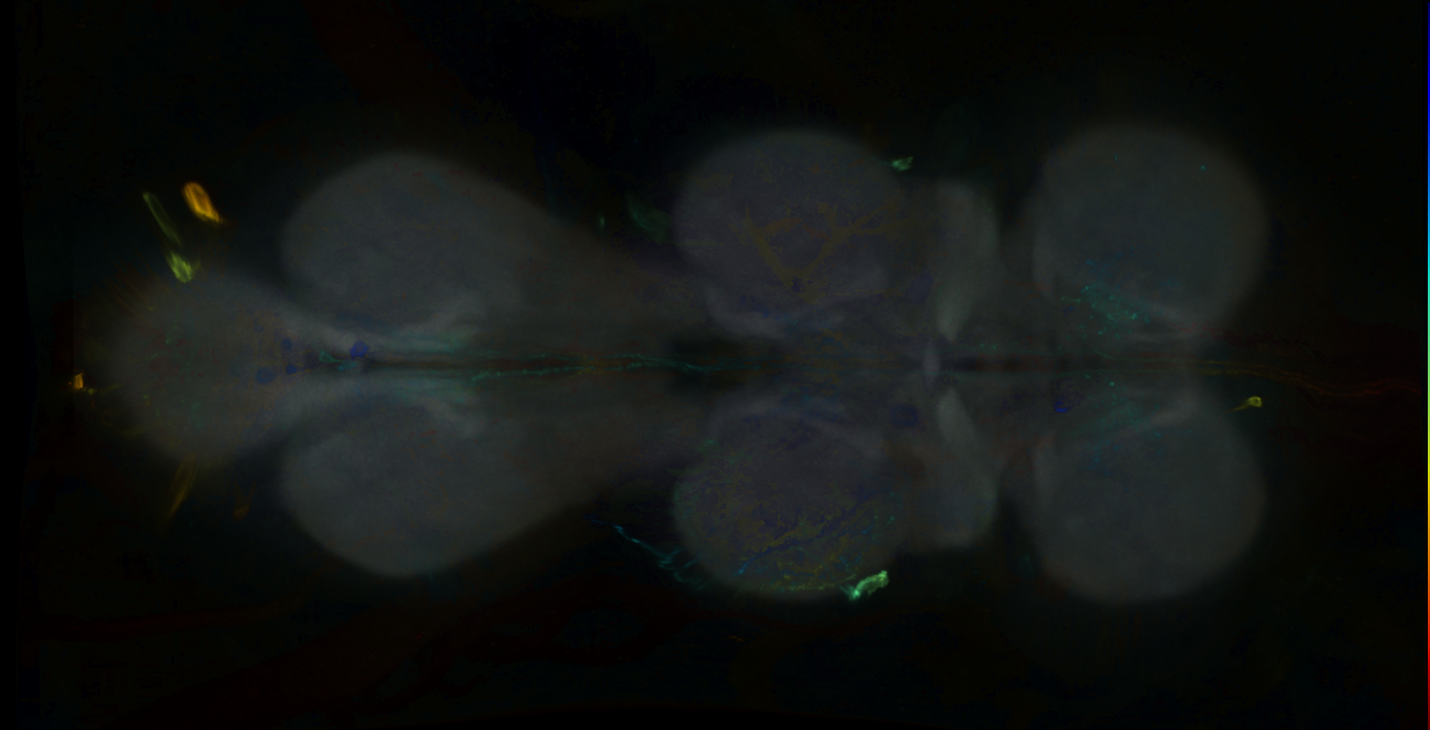 P{GMR73C02-GAL4} expression pattern