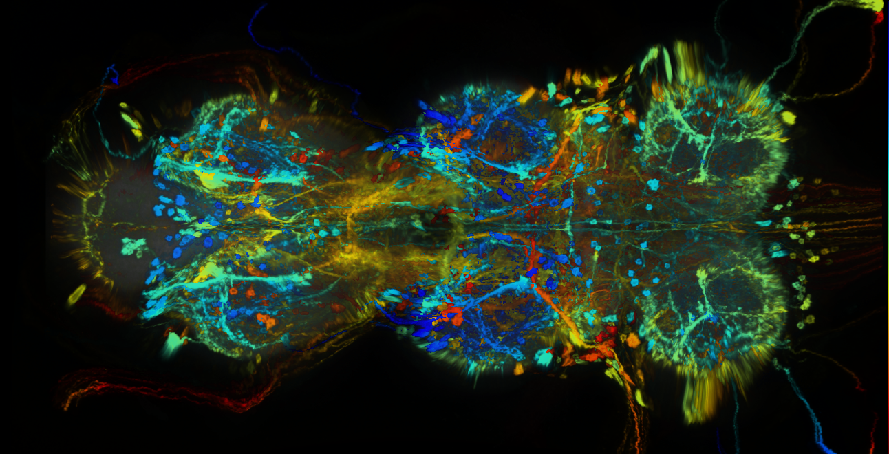 P{GMR73D06-GAL4} expression pattern