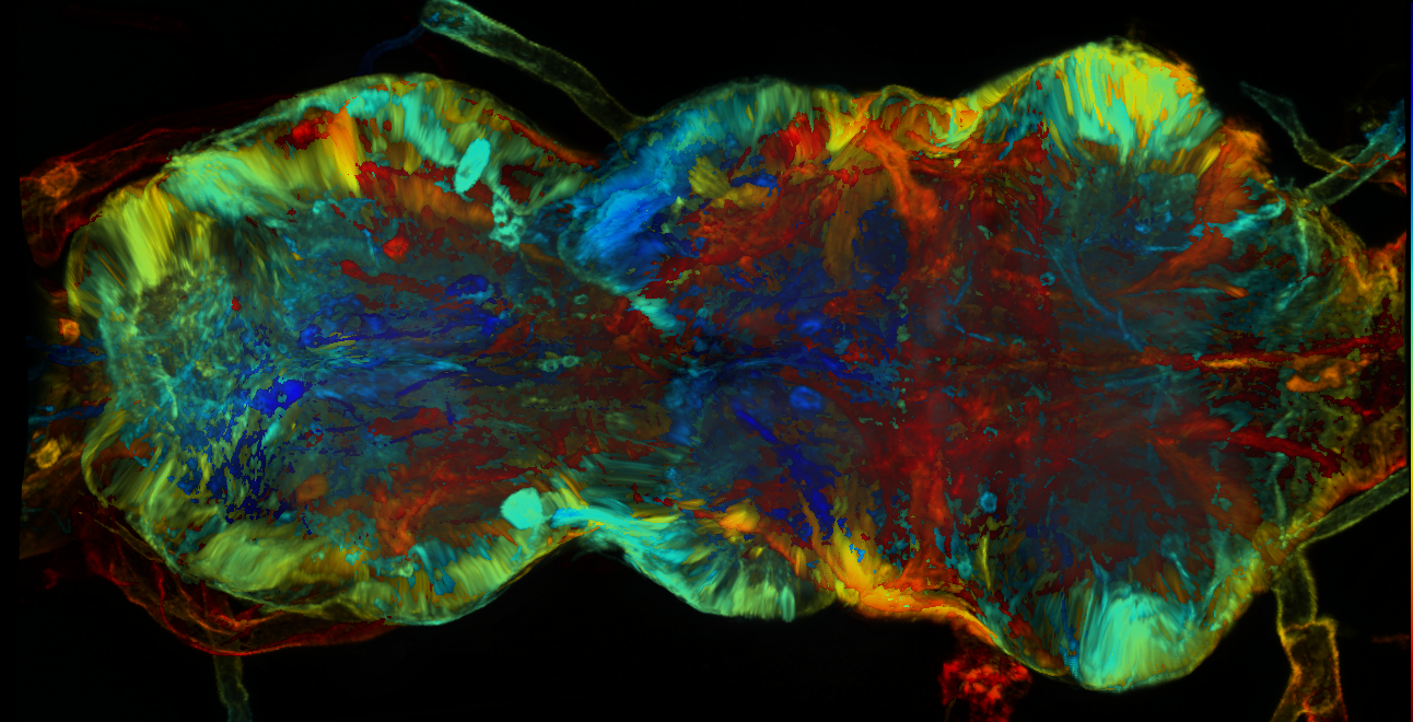 P{GMR73E10-GAL4} expression pattern