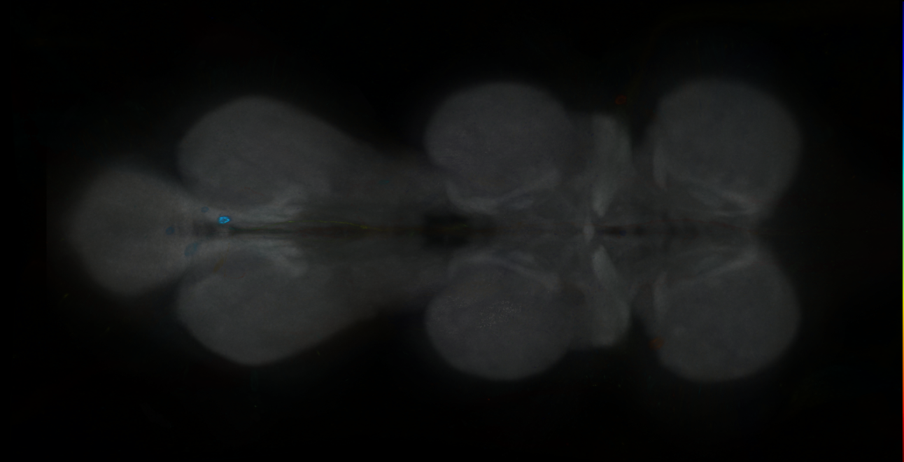 P{GMR73F12-GAL4} expression pattern