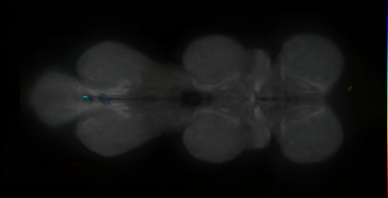P{GMR75C04-GAL4} expression pattern
