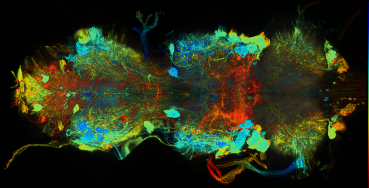 P{GMR75E02-GAL4} expression pattern