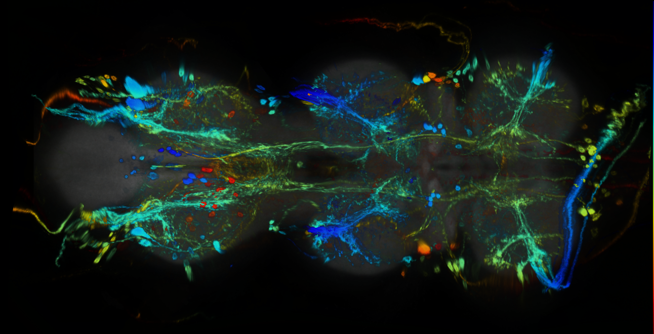 P{GMR75E08-GAL4} expression pattern