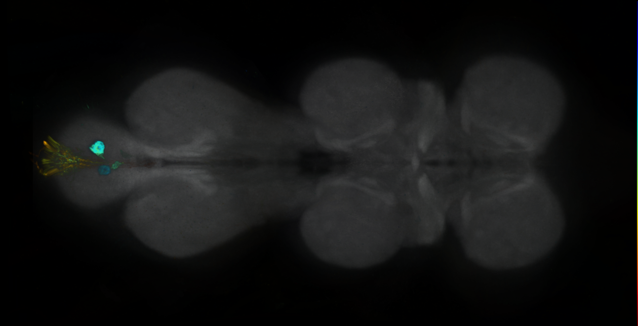 P{GMR75E11-GAL4} expression pattern