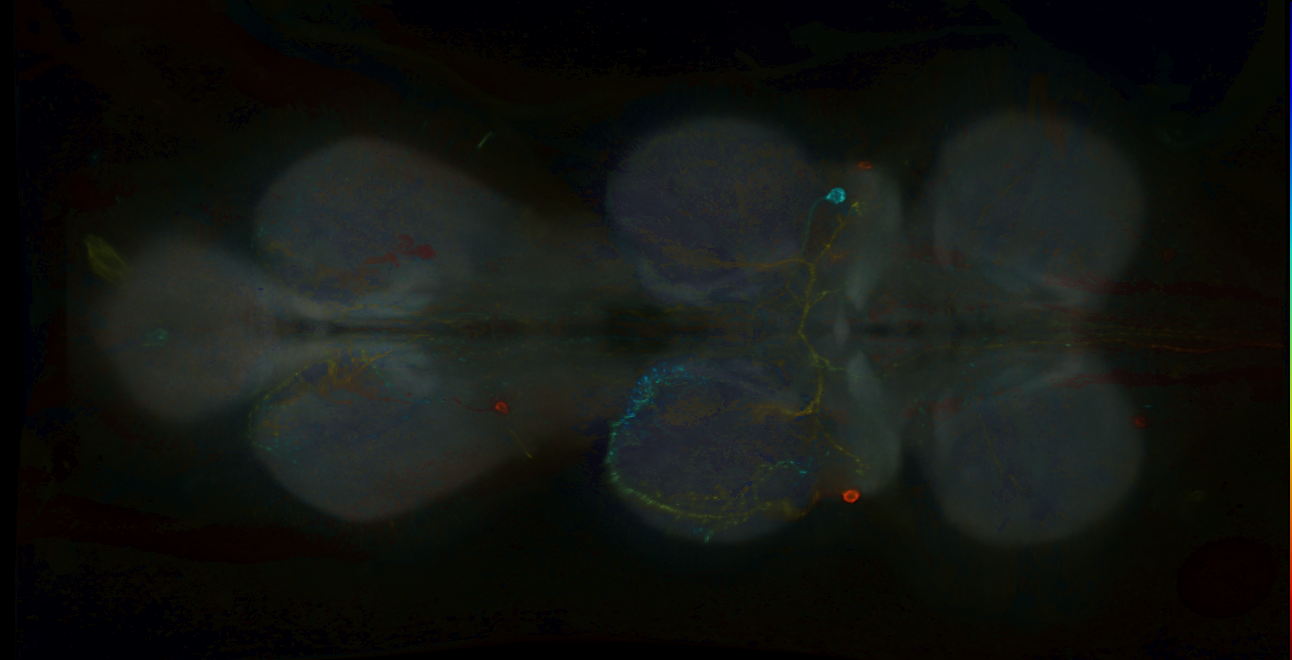 P{GMR75F04-GAL4} expression pattern