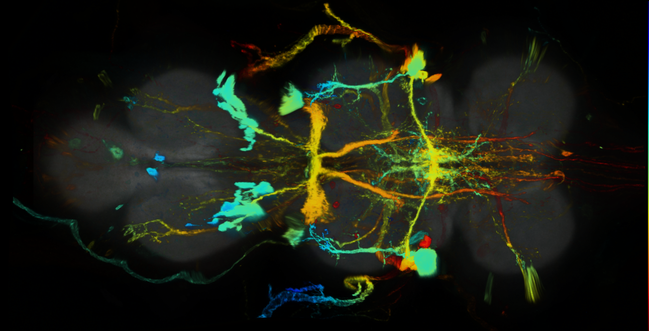 P{GMR75F06-GAL4} expression pattern