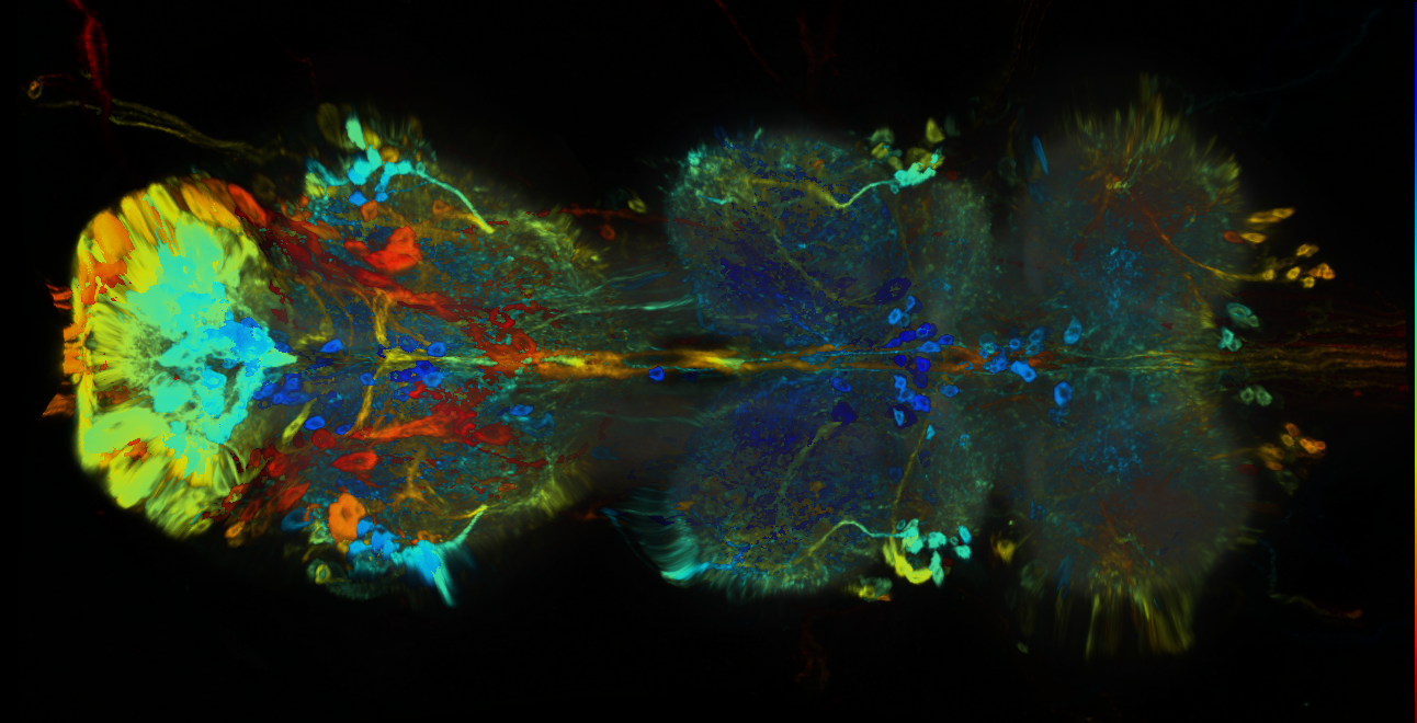 P{GMR76B04-GAL4} expression pattern