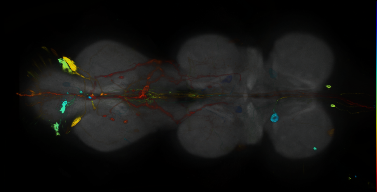P{GMR76B06-GAL4} expression pattern