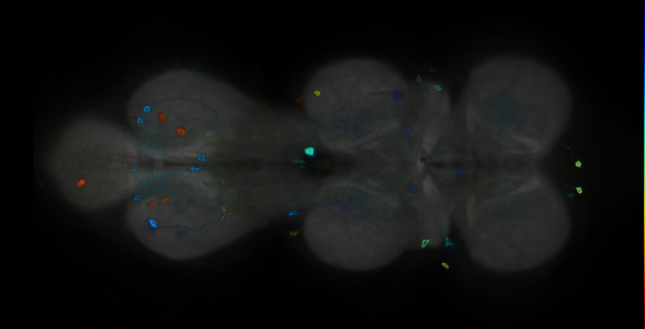P{GMR76C07-GAL4} expression pattern