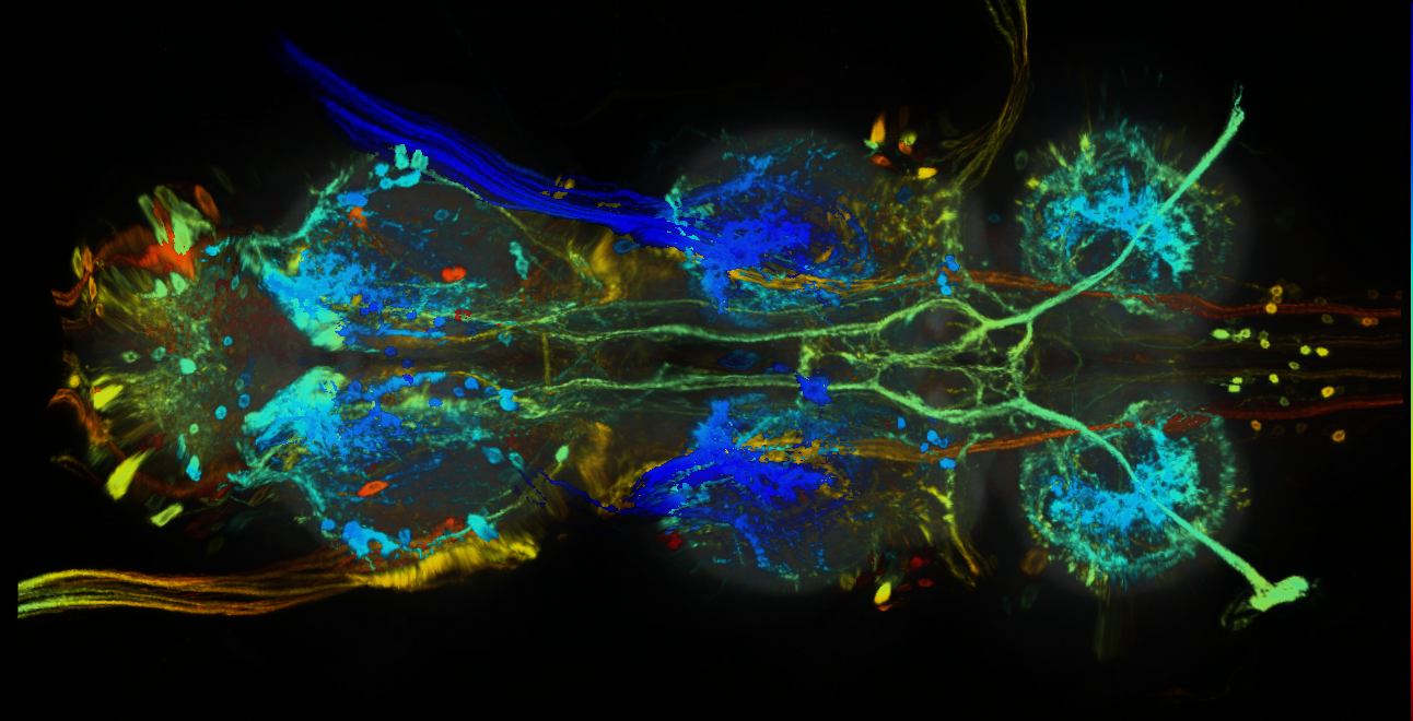 P{GMR76C08-GAL4} expression pattern
