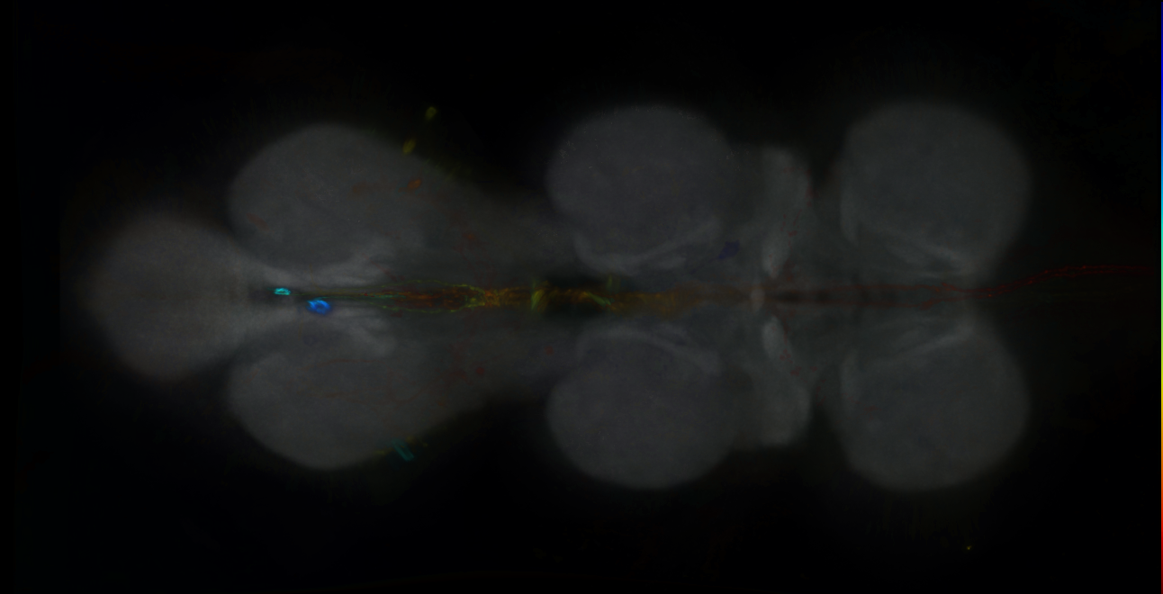P{GMR76D11-GAL4} expression pattern