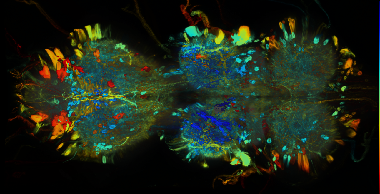 P{GMR77E07-GAL4} expression pattern