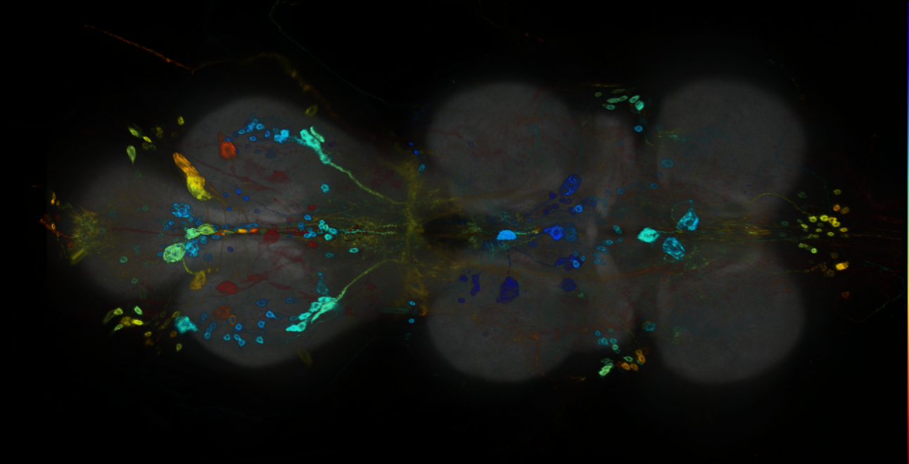 P{GMR77F10-GAL4} expression pattern