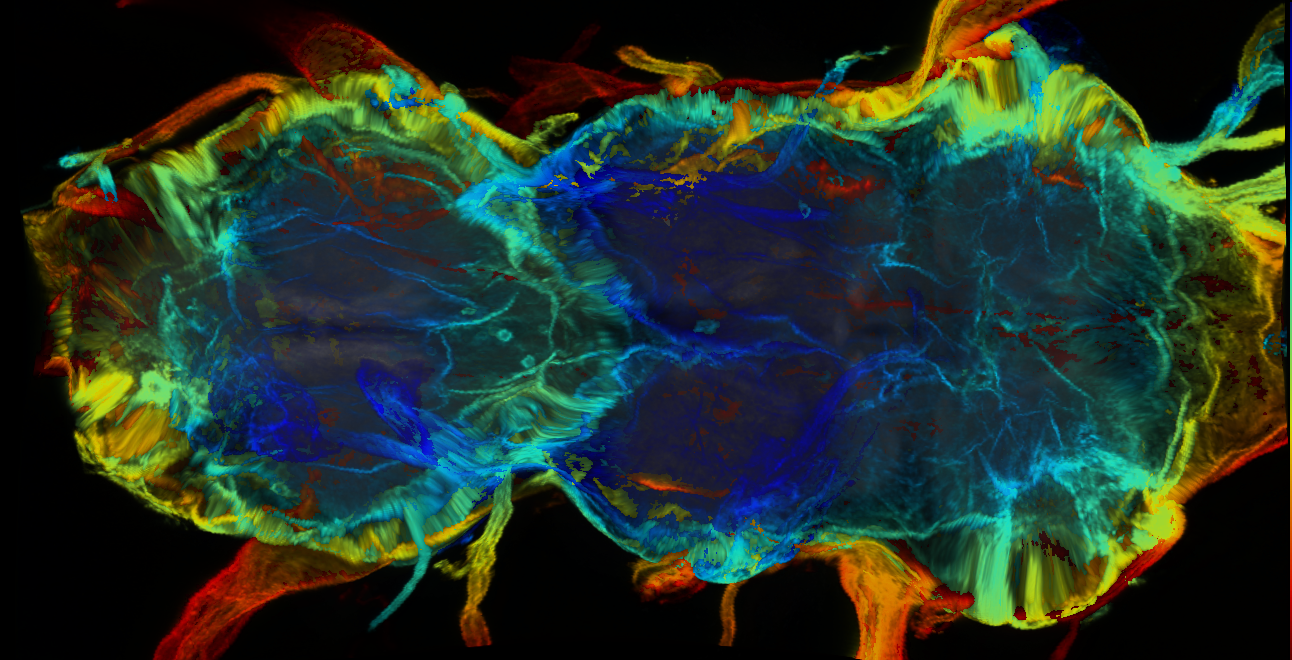 P{GMR77G08-GAL4} expression pattern