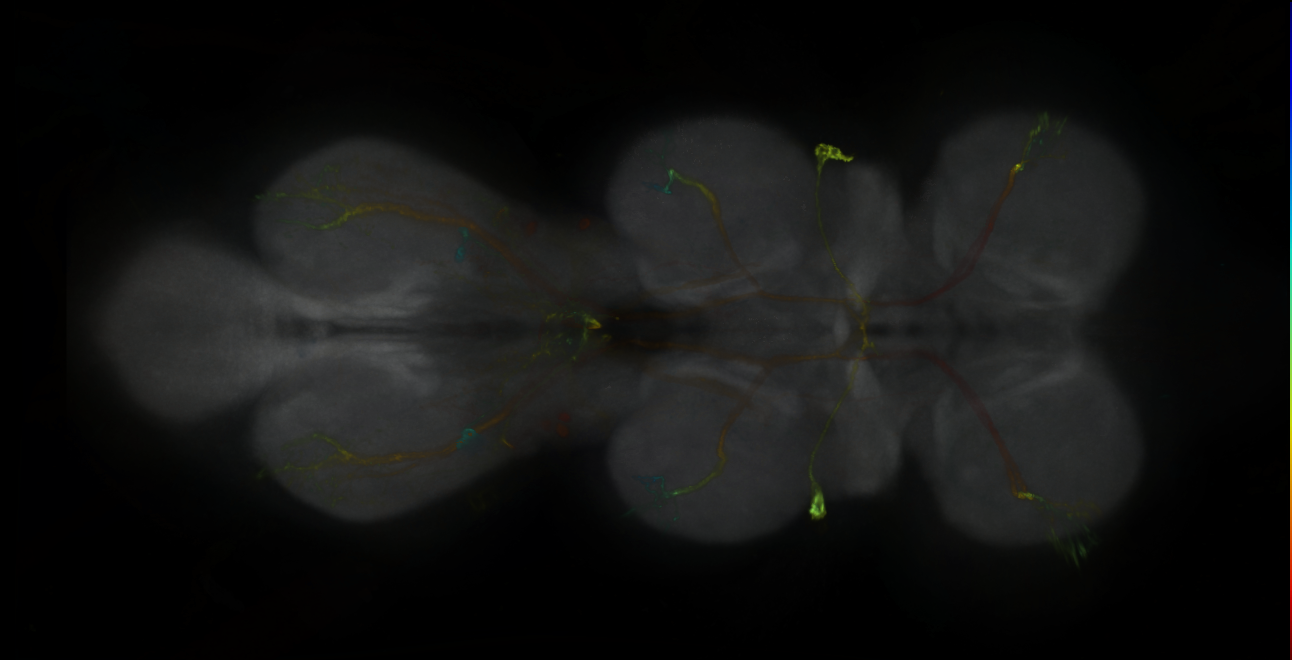 P{GMR78A06-GAL4} expression pattern