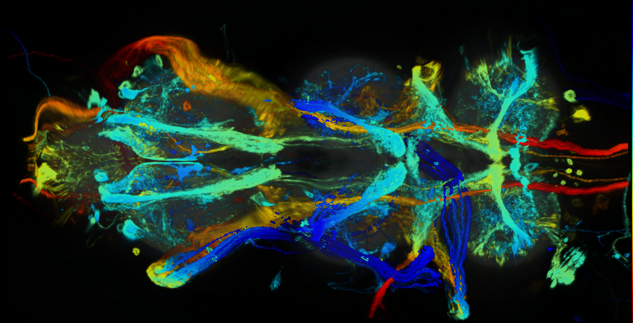 P{GMR78C10-GAL4} expression pattern