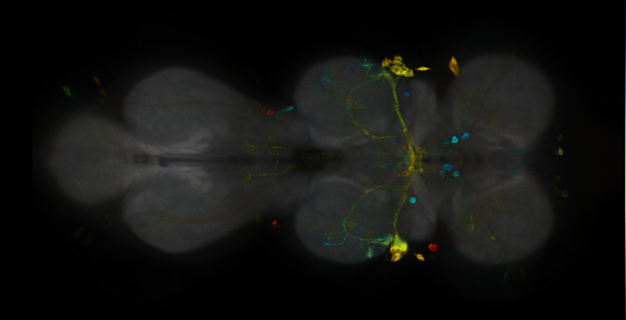 P{GMR78F08-GAL4} expression pattern