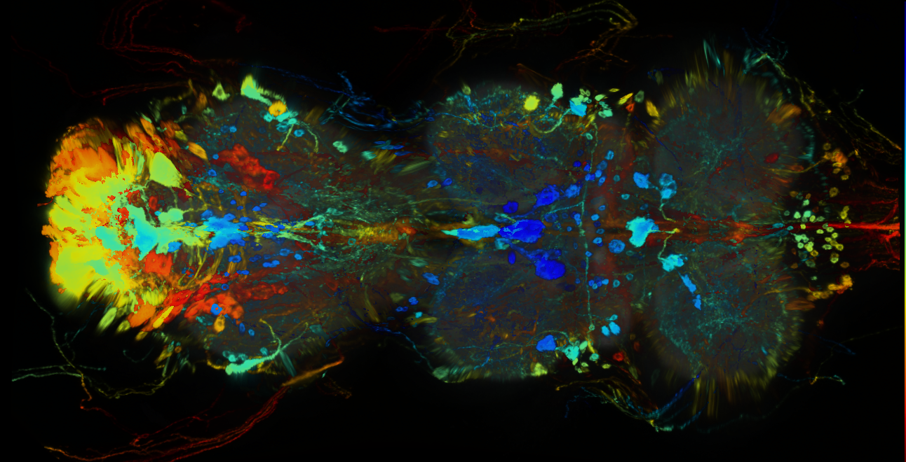 P{GMR78G11-GAL4} expression pattern