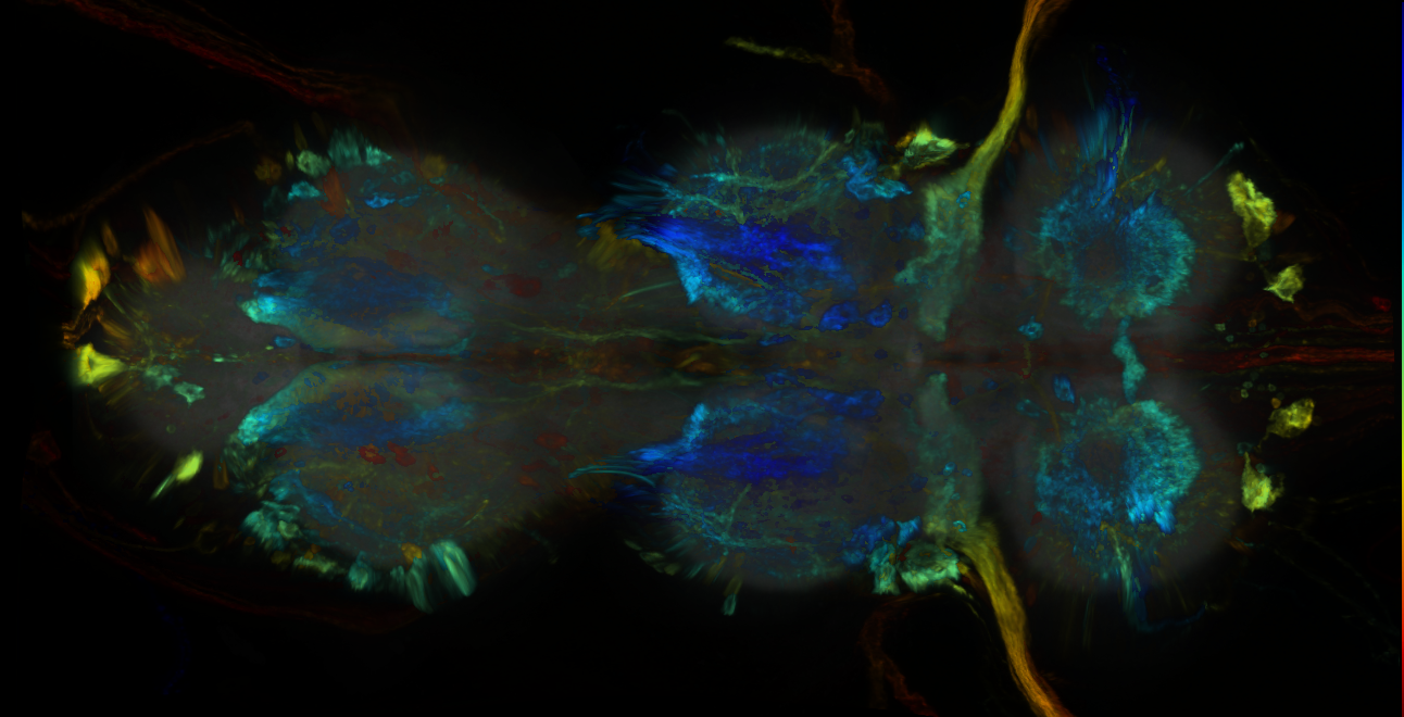 P{GMR78H09-GAL4} expression pattern