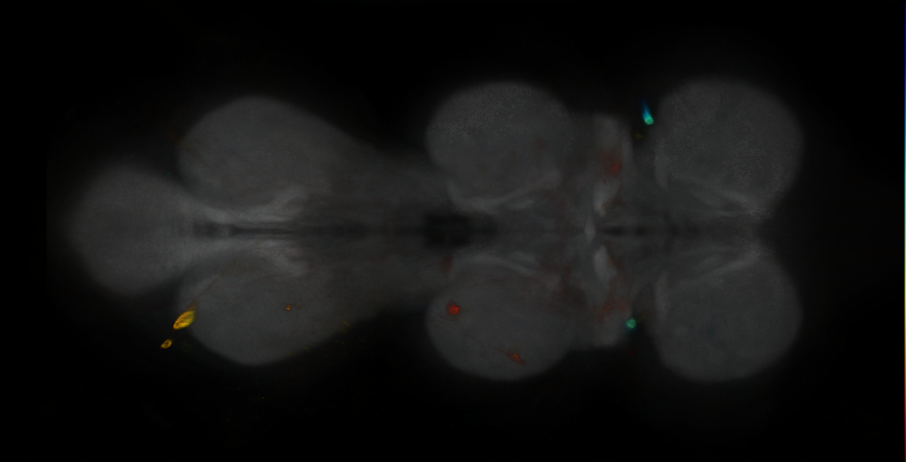 P{GMR79A06-GAL4} expression pattern