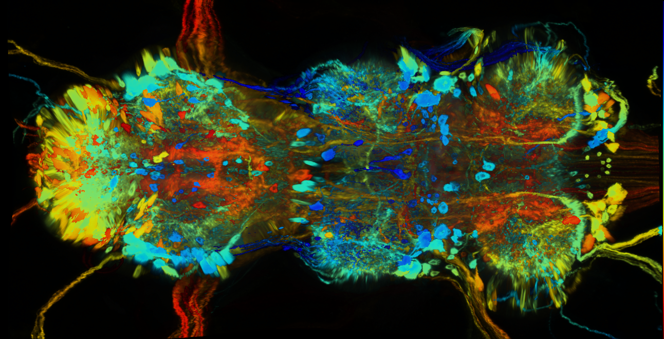 P{GMR79A07-GAL4} expression pattern