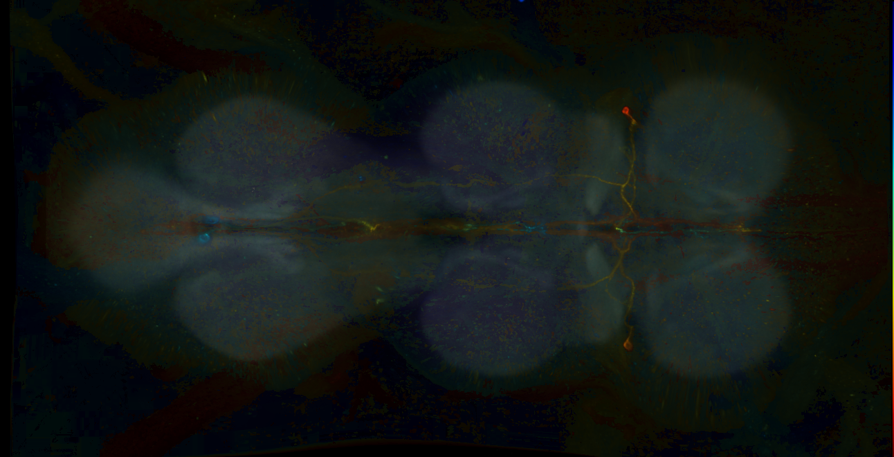 P{GMR79A08-GAL4} expression pattern