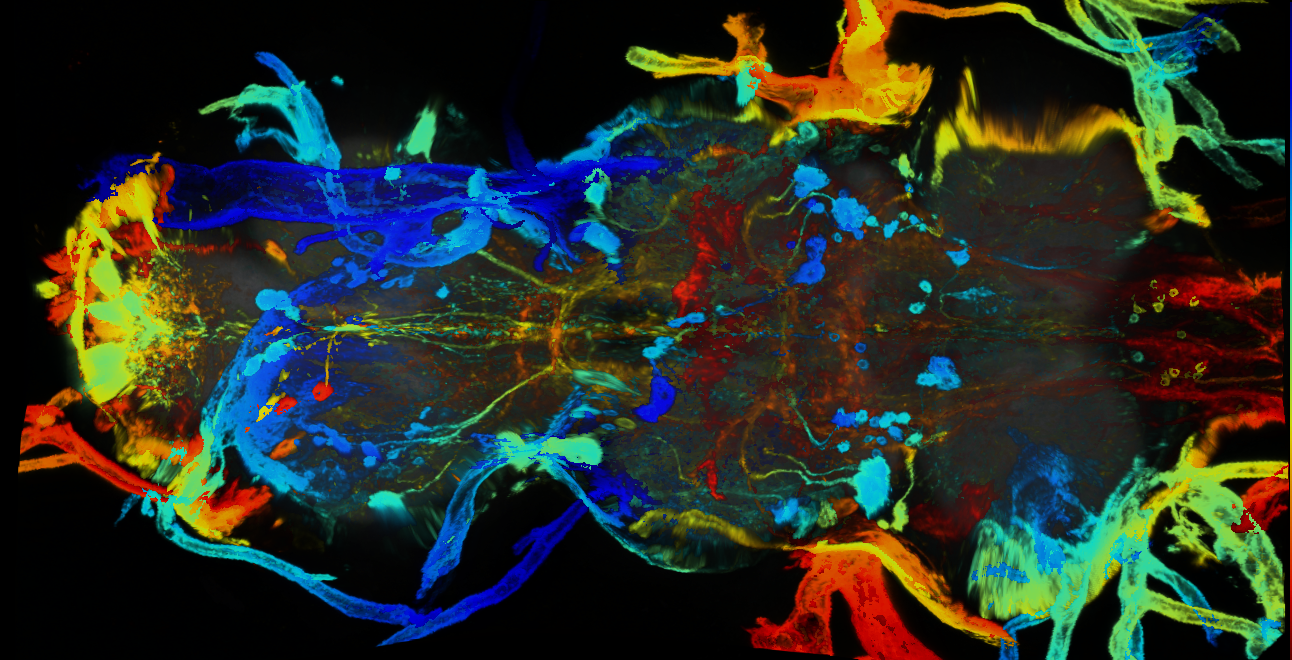 P{GMR79C02-GAL4} expression pattern