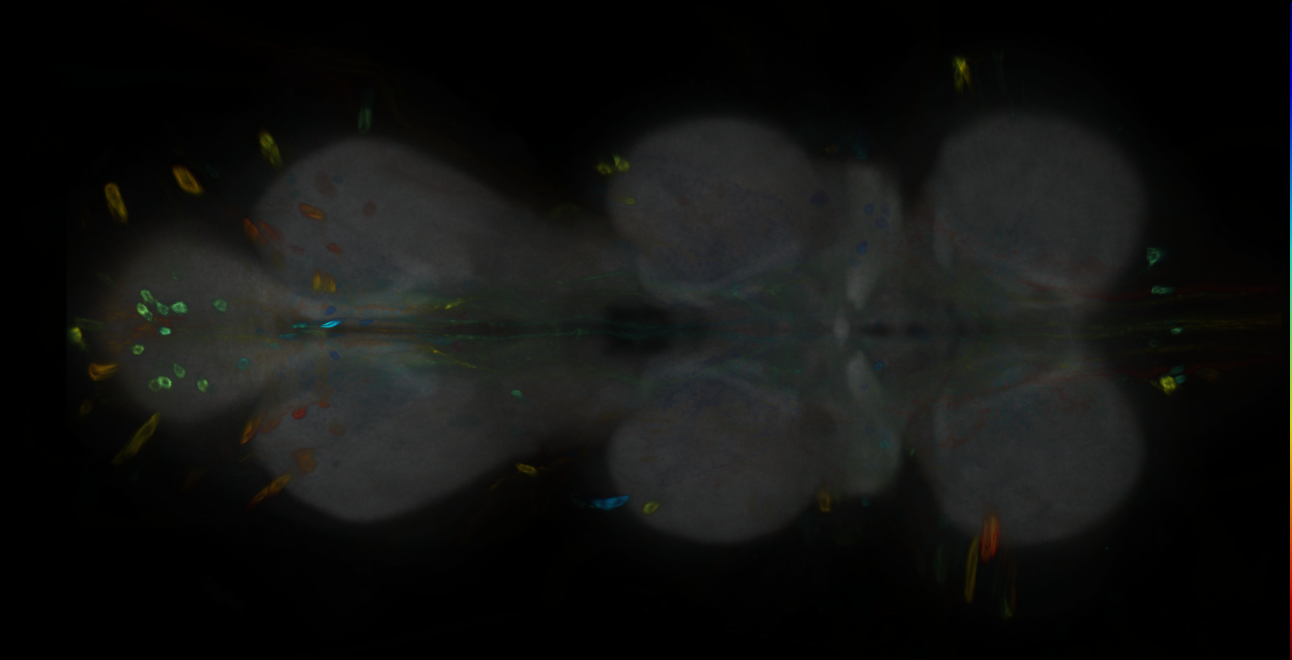 P{GMR79D10-GAL4} expression pattern