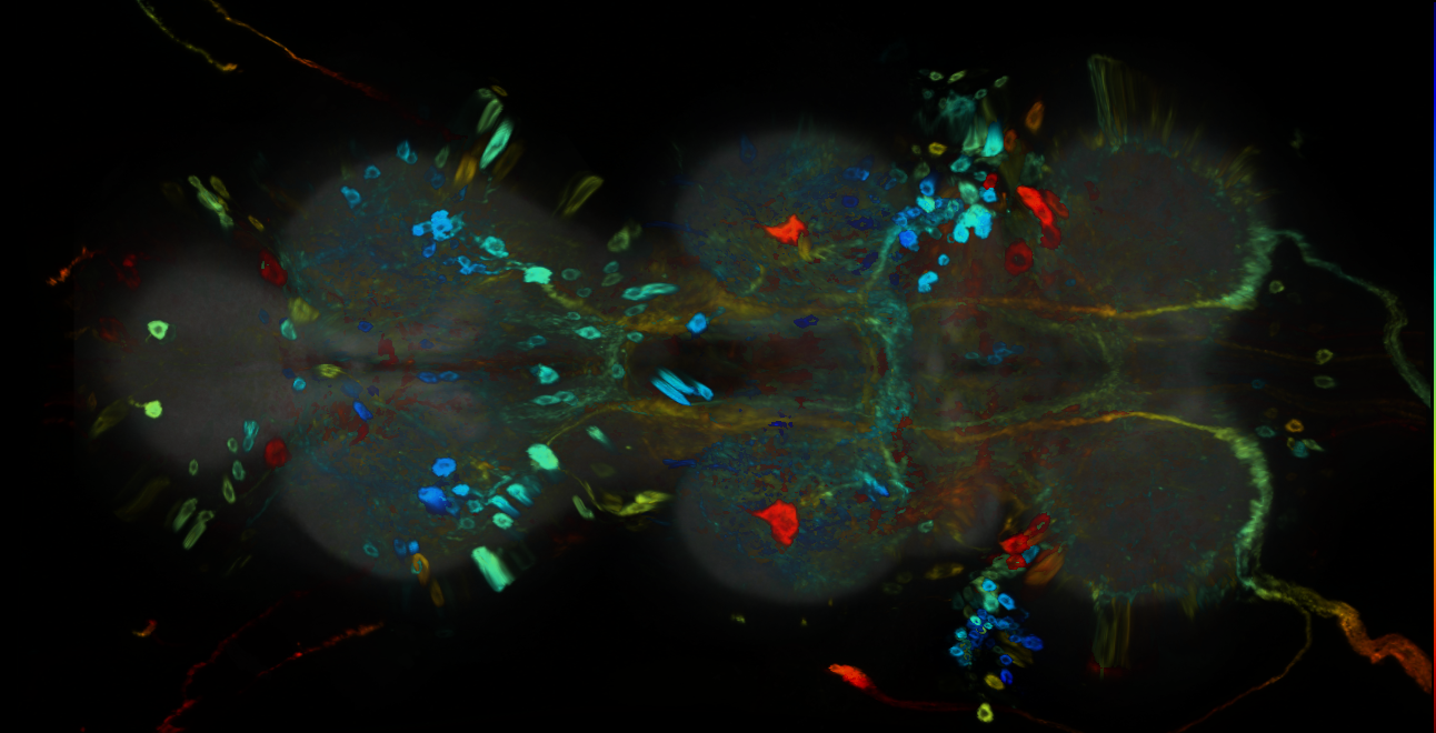 P{GMR79E04-GAL4} expression pattern