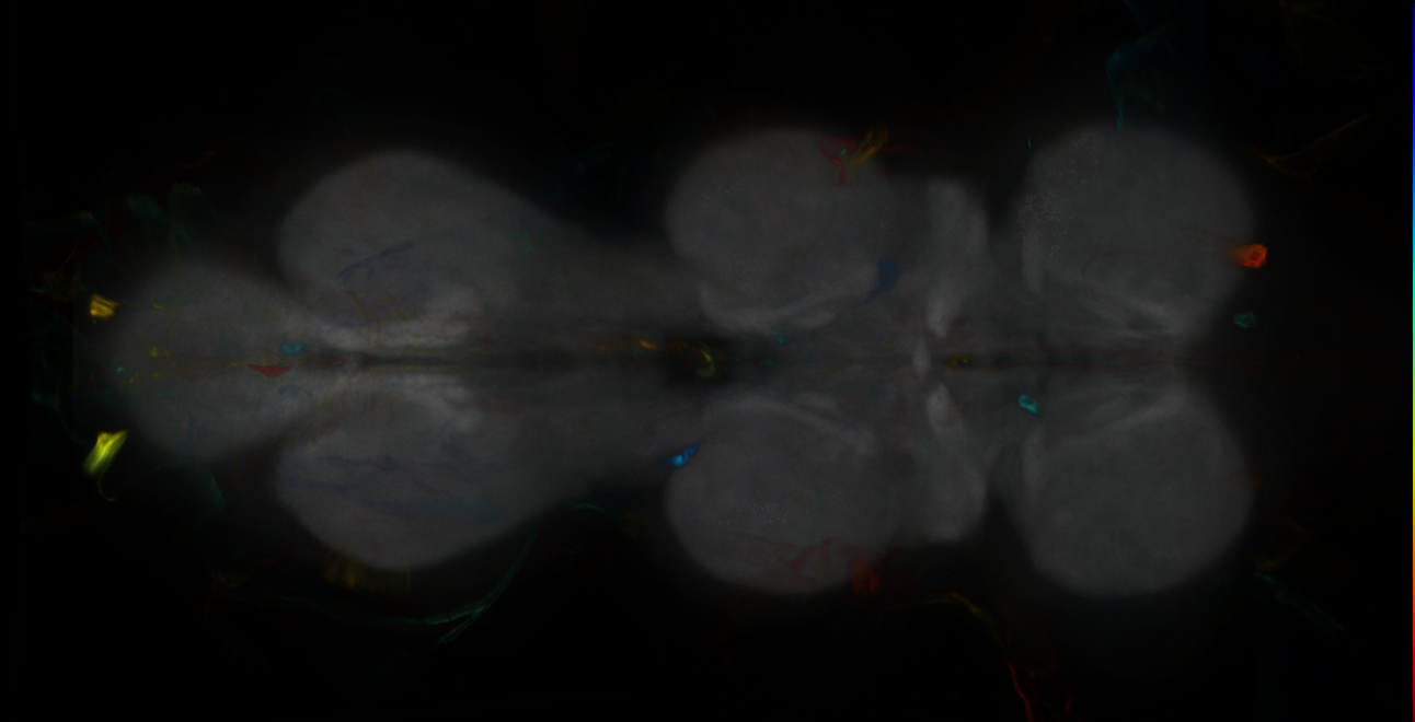 P{GMR79G07-GAL4} expression pattern